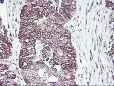 Immunohistochemistry-Paraffin: PDRG1 Antibody (OTI4F12) [NBP2-01854]