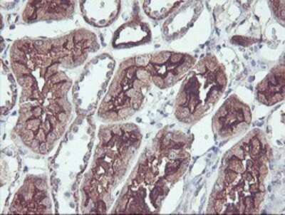 Immunohistochemistry-Paraffin: PDRG1 Antibody (OTI4F12) [NBP2-01854]