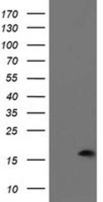 Western Blot: PDRG1 Antibody (OTI4F12) [NBP2-01854]