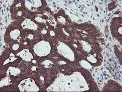 Immunohistochemistry: PDRG1 Antibody (OTI4F12) - Azide and BSA Free [NBP2-73320]