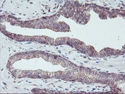 Immunohistochemistry: PDRG1 Antibody (OTI4F12) - Azide and BSA Free [NBP2-73320]