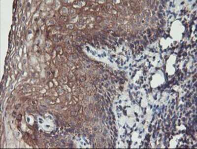 Immunohistochemistry: PDRG1 Antibody (OTI4F12) - Azide and BSA Free [NBP2-73320]