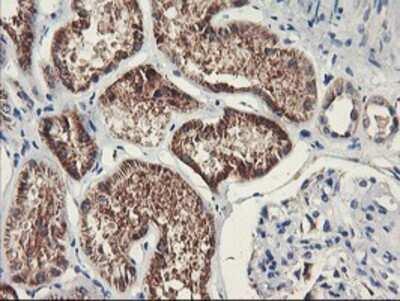Immunohistochemistry-Paraffin: PDSS2 Antibody (OTI1D12) [NBP2-01512]