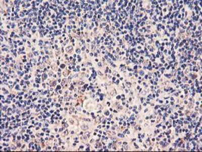 Immunohistochemistry-Paraffin: PDSS2 Antibody (OTI1D12) [NBP2-01512]
