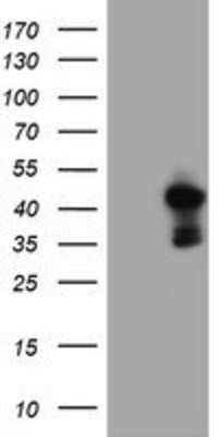 Western Blot: PDSS2 Antibody (OTI1D12) [NBP2-01512]