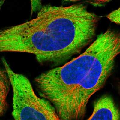 Immunocytochemistry/ Immunofluorescence: PDSS2 Antibody [NBP1-88739]