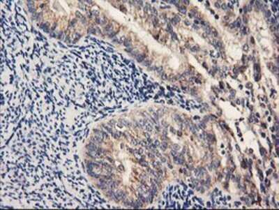 Immunohistochemistry: PDSS2 Antibody (OTI1D12) - Azide and BSA Free [NBP2-73323]