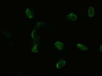 Immunocytochemistry/ Immunofluorescence: PDX-1/IPF1 Antibody (OTI2A12) [NBP1-47910]