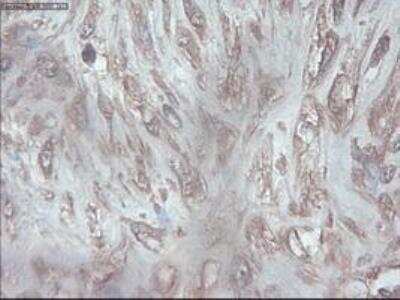 Immunohistochemistry-Paraffin: PDX-1/IPF1 Antibody (OTI2A12) [NBP1-47910]