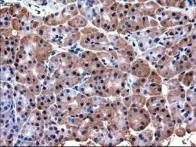 Immunohistochemistry: PDX-1/IPF1 Antibody (OTI2A12) - Azide and BSA Free [NBP2-73330]