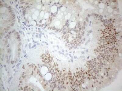 Immunohistochemistry: PDX-1/IPF1 Antibody (OTI3H3) - Azide and BSA Free [NBP2-73332]
