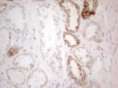 Immunohistochemistry: PDX-1/IPF1 Antibody (OTI3H3) - Azide and BSA Free [NBP2-73332]