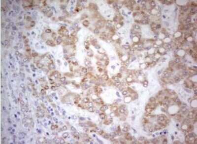 Immunohistochemistry-Paraffin: PDX-1/IPF1 Antibody (OTI3H3) [NBP2-46371]