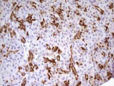 Immunohistochemistry-Paraffin: PDX-1/IPF1 Antibody (OTI3H3) [NBP2-46371]