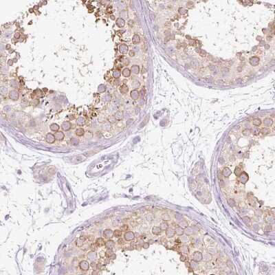 Immunohistochemistry-Paraffin: PDXDC1 Antibody [NBP2-30594]