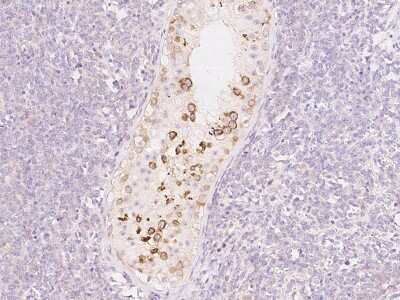 Immunohistochemistry-Paraffin: PDXDC1 Antibody [NBP2-97693]