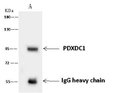 Immunoprecipitation: PDXDC1 Antibody [NBP2-97693]