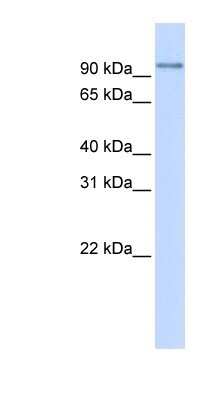 Western Blot: PDXDC1 Antibody [NBP1-56776]