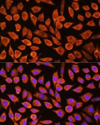 Immunocytochemistry/ Immunofluorescence: PDXP Antibody - Azide and BSA Free [NBP2-93574]