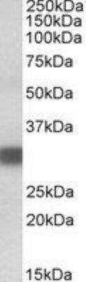 Western Blot: PDXP Antibody [NBP2-27461]