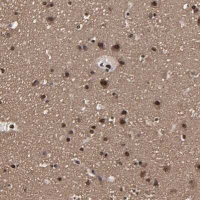 Immunohistochemistry-Paraffin: PDZD4 Antibody [NBP1-93845]