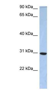 Western Blot: PDZD9 Antibody [NBP1-56800]