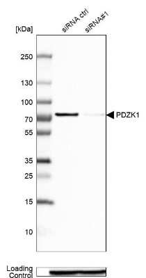 Western Blot: PDZK1 Antibody [NBP1-82572]