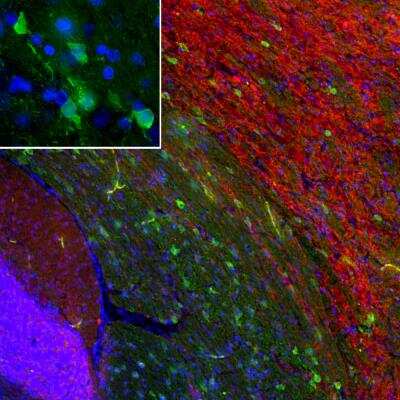 Immunocytochemistry/ Immunofluorescence: PEA-15 Antibody [NBP3-05543]