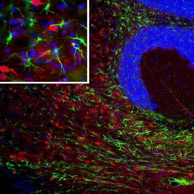 Immunocytochemistry/ Immunofluorescence: PEA-15 Antibody [NBP3-05544]