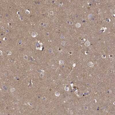 Immunohistochemistry-Paraffin: PEA-15 Antibody [NBP2-62670]