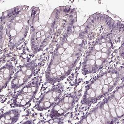 Immunohistochemistry-Paraffin: PEA-15 Antibody [NBP2-62670]