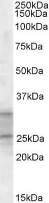 Western Blot: PEBP4 Antibody [NBP1-46155]