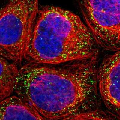 Immunocytochemistry/ Immunofluorescence: PECR Antibody [NBP1-83198]