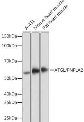 Western Blot: PEDFR/PNPLA2/ATGL Antibody (10Y4M10) [NBP3-16567]