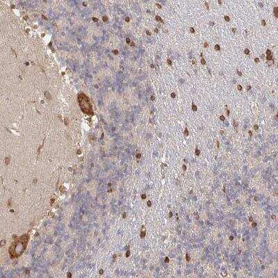 Immunohistochemistry-Paraffin: PELI3 Antibody [NBP2-37988]