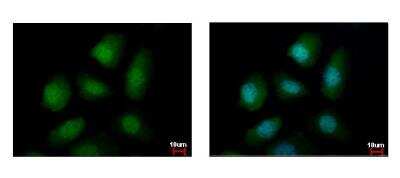 Immunocytochemistry/ Immunofluorescence: PELO Antibody [NBP2-19769]