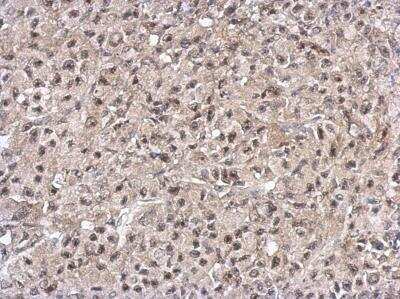 Immunohistochemistry-Paraffin: PELO Antibody [NBP2-19769]