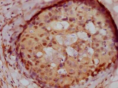 Immunohistochemistry: PELP1 Antibody (6H4) [NBP3-15157]