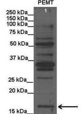 Western Blot: PEMT Antibody [NBP1-59580]