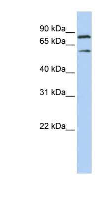 Western Blot: PEO1 Antibody [NBP1-57356]