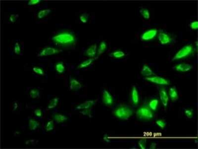 Immunocytochemistry/ Immunofluorescence: PEPD Antibody (1D5-H3) [H00005184-M01]