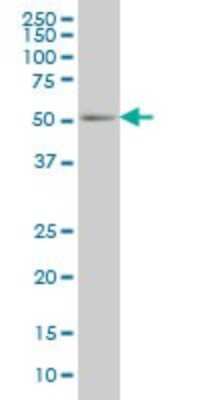 Western Blot: PEPD Antibody (1D5-H3) [H00005184-M01]