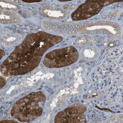Immunohistochemistry-Paraffin: PEPD Antibody [NBP1-86072]