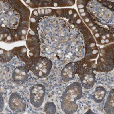 Immunohistochemistry-Paraffin: PEPD Antibody [NBP1-86072]