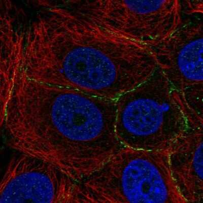 Immunocytochemistry/ Immunofluorescence: PEPP3 Antibody [NBP2-55312]
