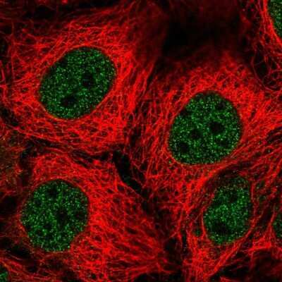 Immunocytochemistry/ Immunofluorescence: PEPT1/SLC15A1 Antibody [NBP1-92005]