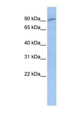 Western Blot: PEPT2/SLC15A2 Antibody [NBP1-59626]