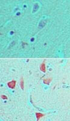 Immunohistochemistry-Paraffin: PER1 Antibody [NBP2-24589]