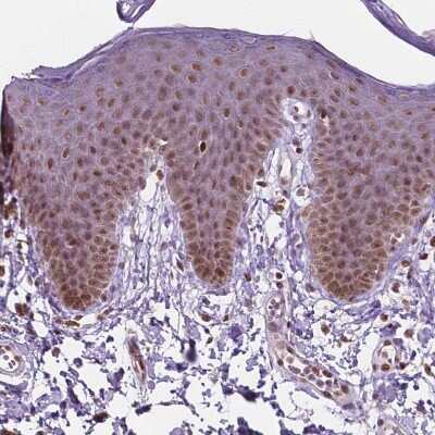 Immunohistochemistry-Paraffin: PER2 Antibody [NBP2-49316]