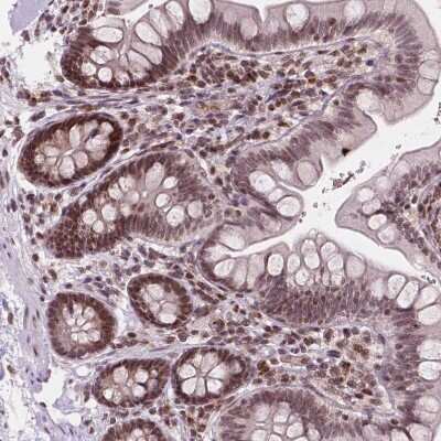 Immunohistochemistry-Paraffin: PER2 Antibody [NBP2-49316]